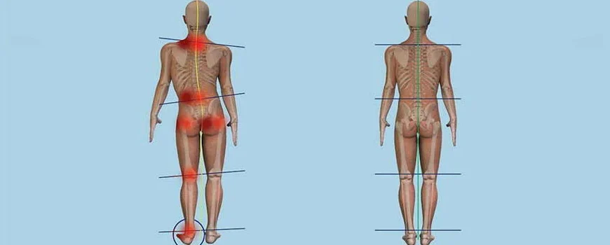 Dorn Method Egzersizleri